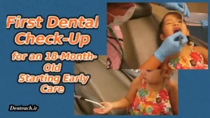 First Dental Check-Up for an 18-Month-Old: Starting Early Care