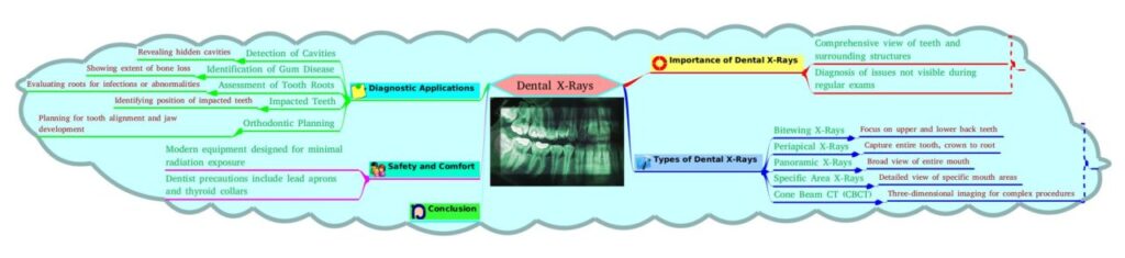 Dental X-Rays mind map