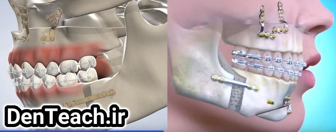 Oral and maxillofacial surgery