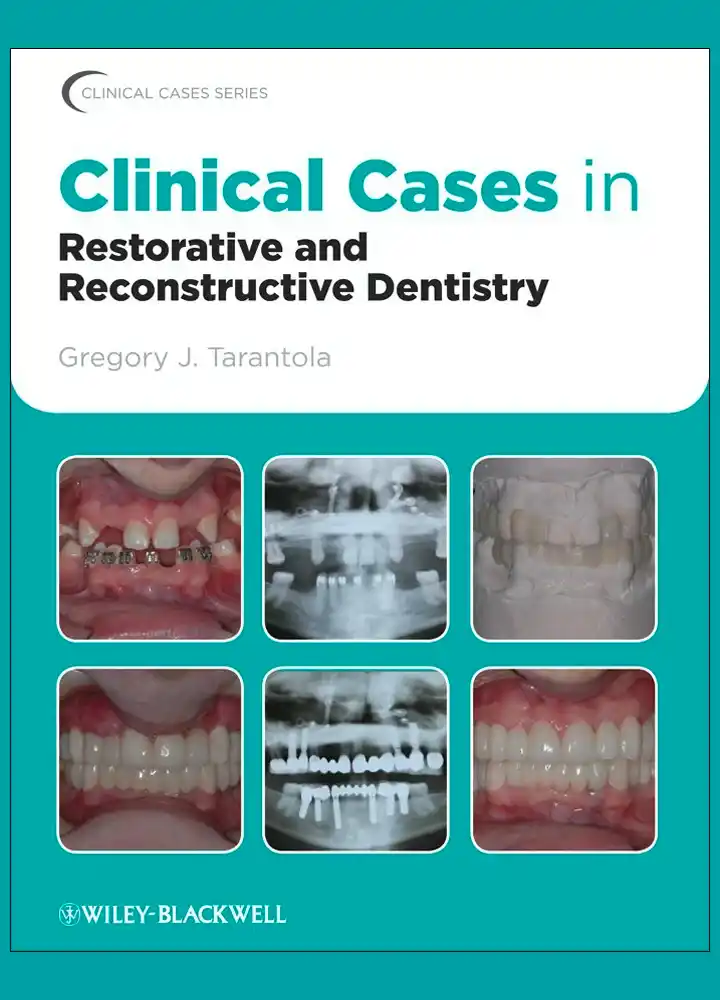 clinical cases restorative reconstructive dentistry tarantola