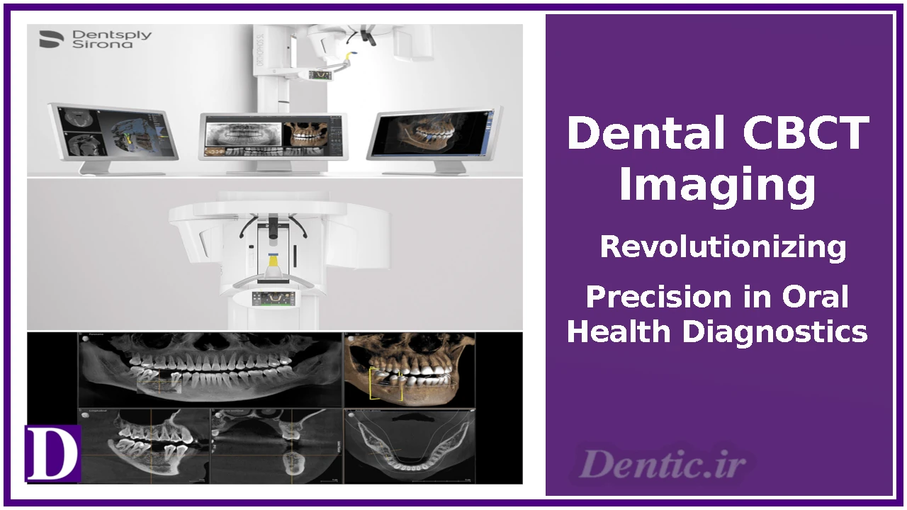 Dental CBCT