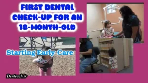 First Dental Check-Up for an 18-Month-Old: Starting Early Care
