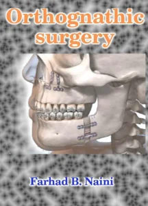 Orthognathic surgery Farhad B. Naini textbook PDF