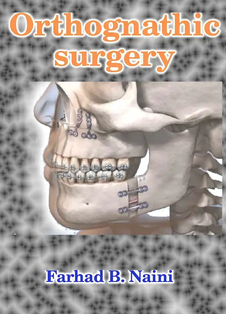 Orthognathic surgery Farhad B. Naini textbook PDF