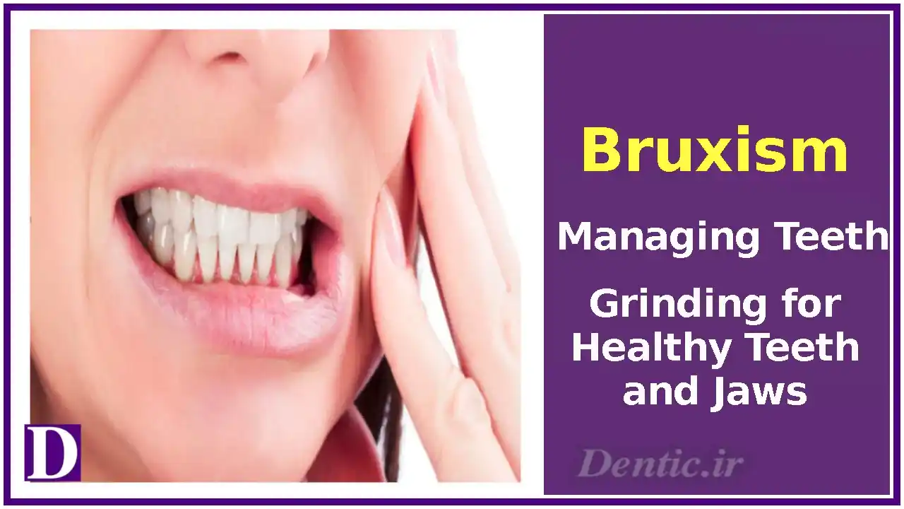 Bruxism: Managing Teeth Grinding for Healthy Teeth and Jaws