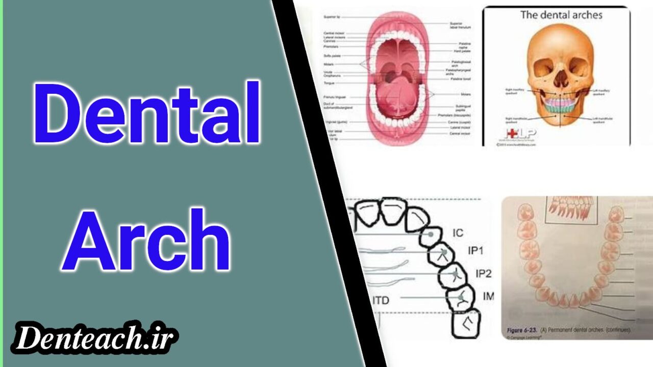 Dental Arch