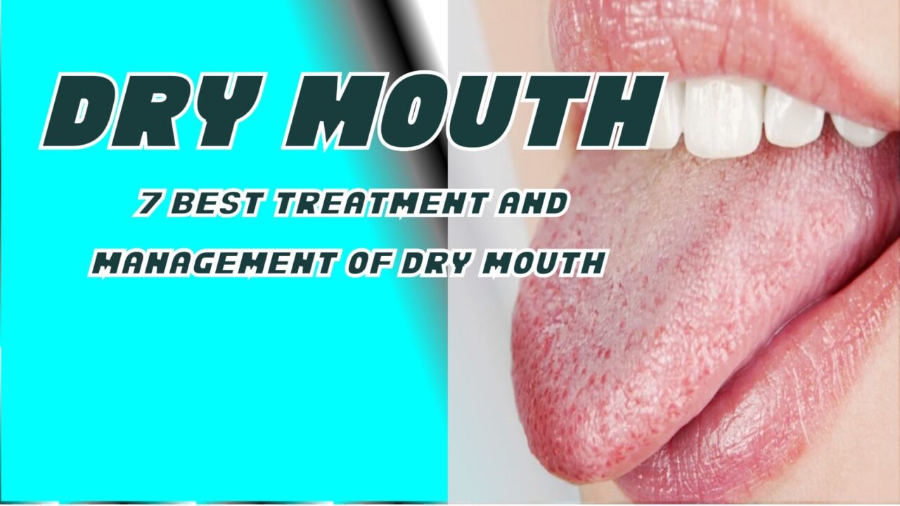 Dry Mouth
