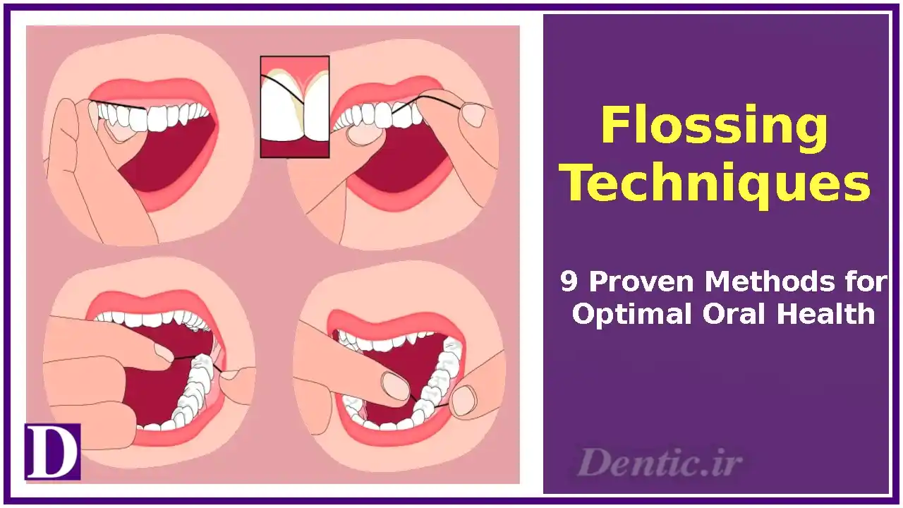 Flossing Techniques