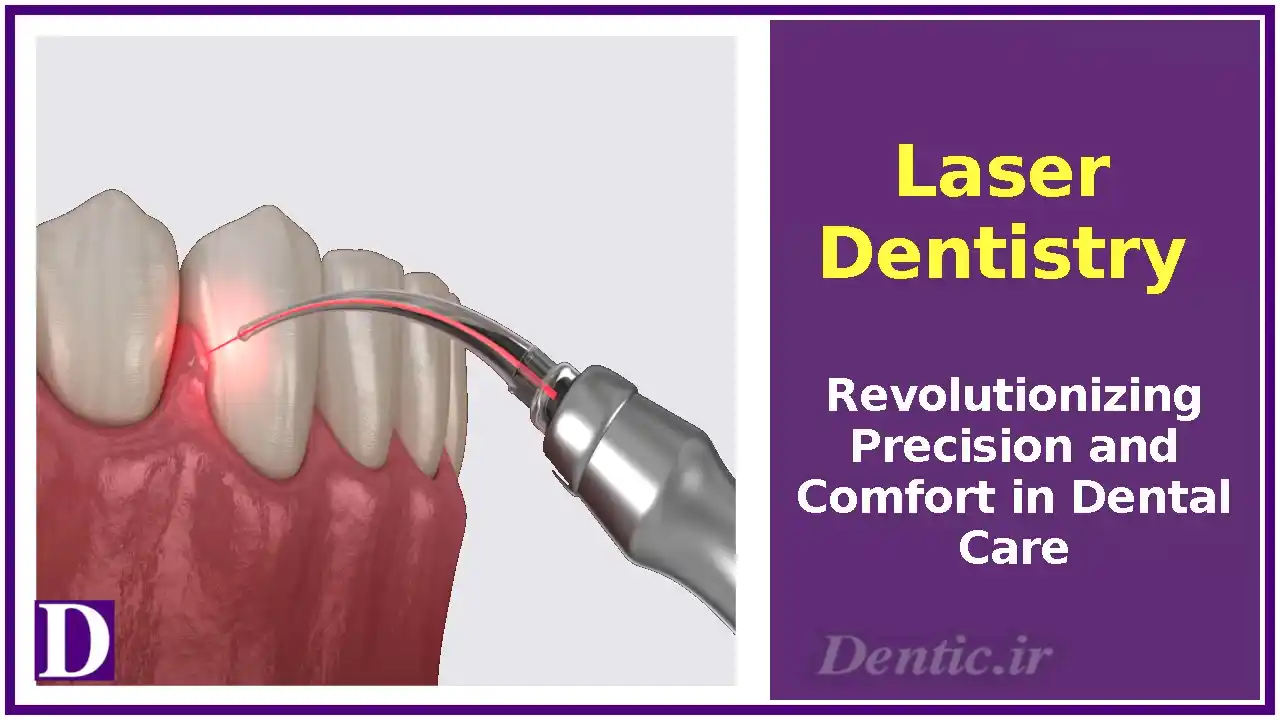 Laser Dentistry