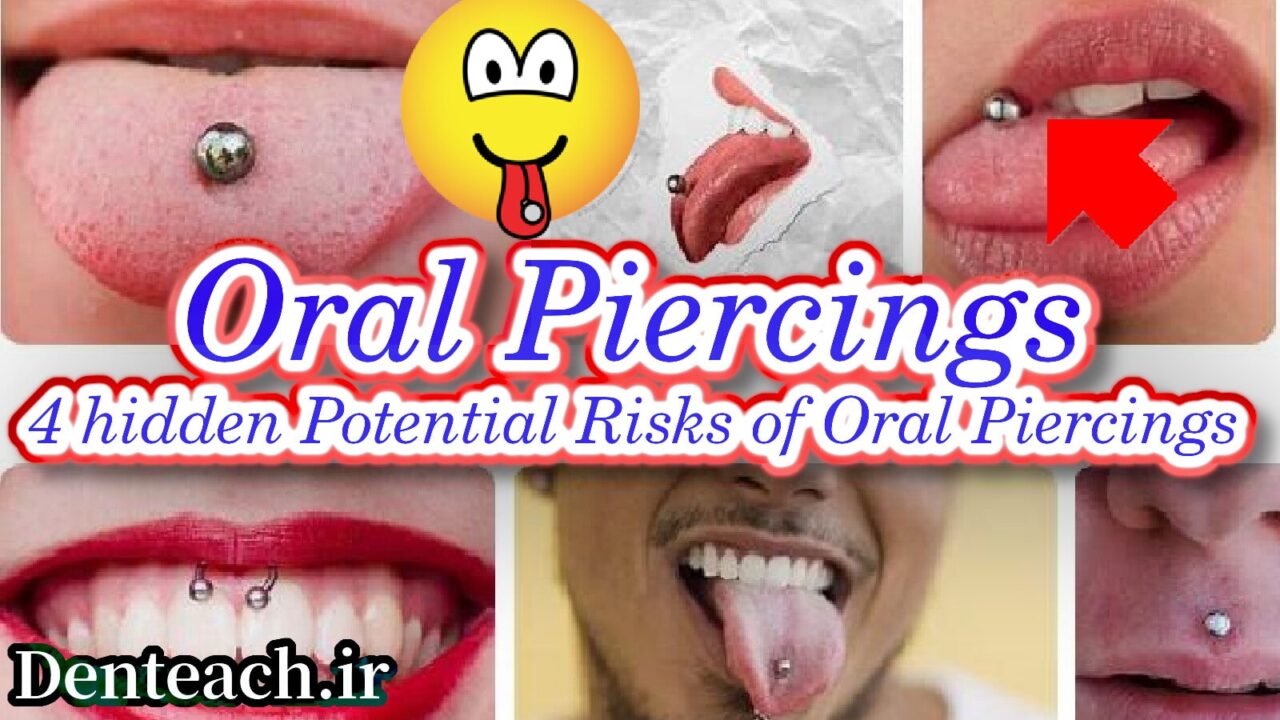 Oral Piercings