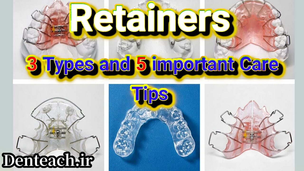 Retainers
