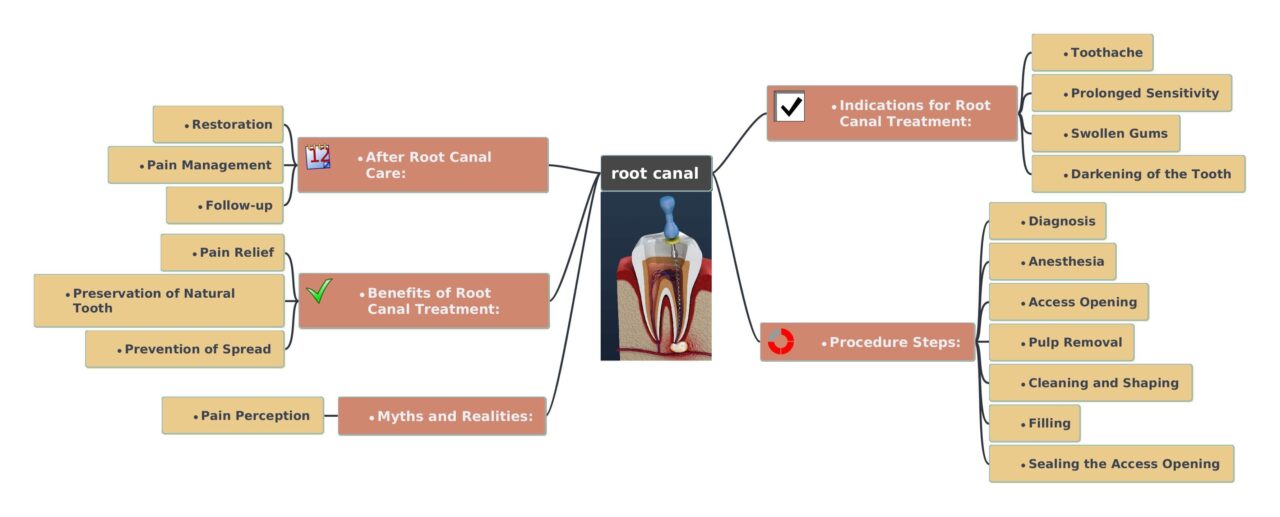 Root Canal mind map