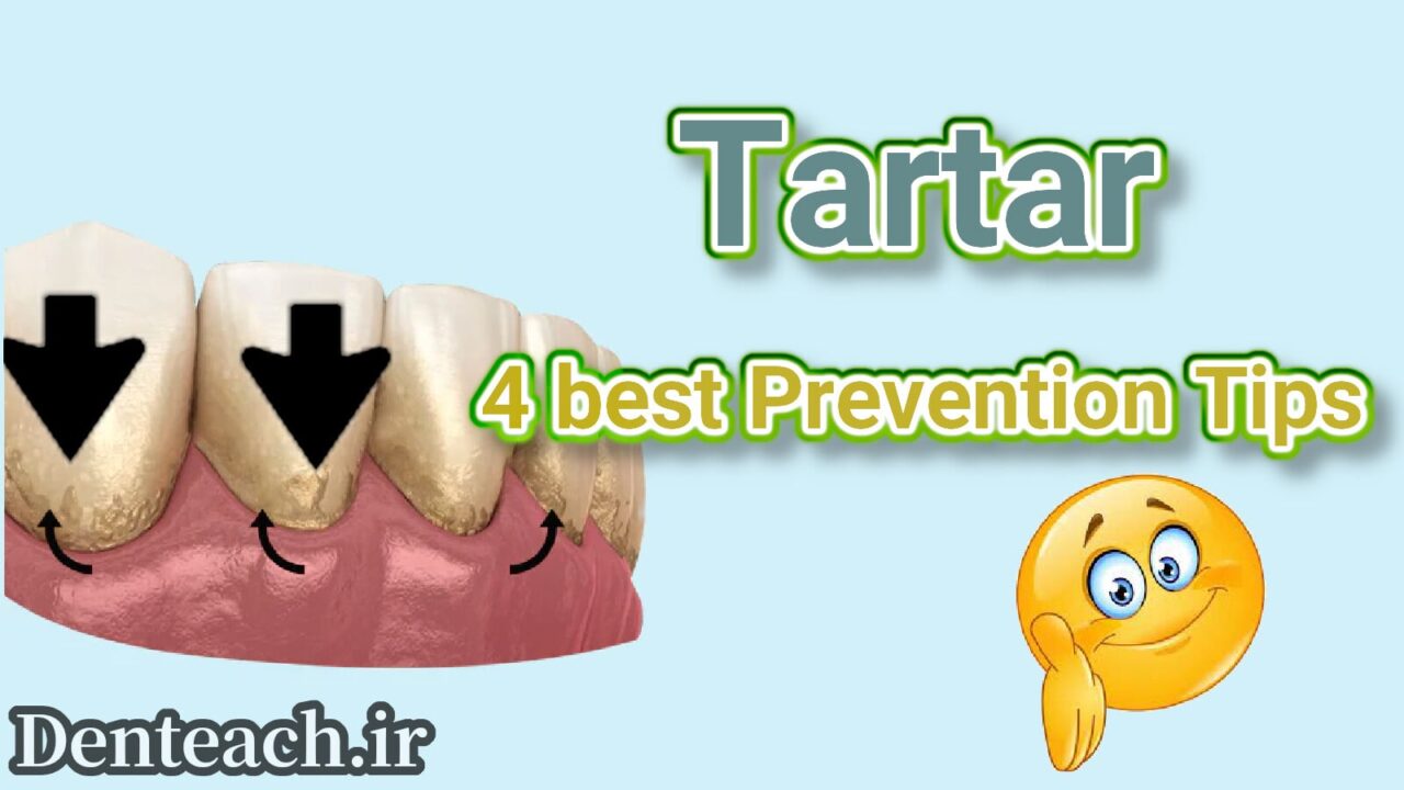 Tartar