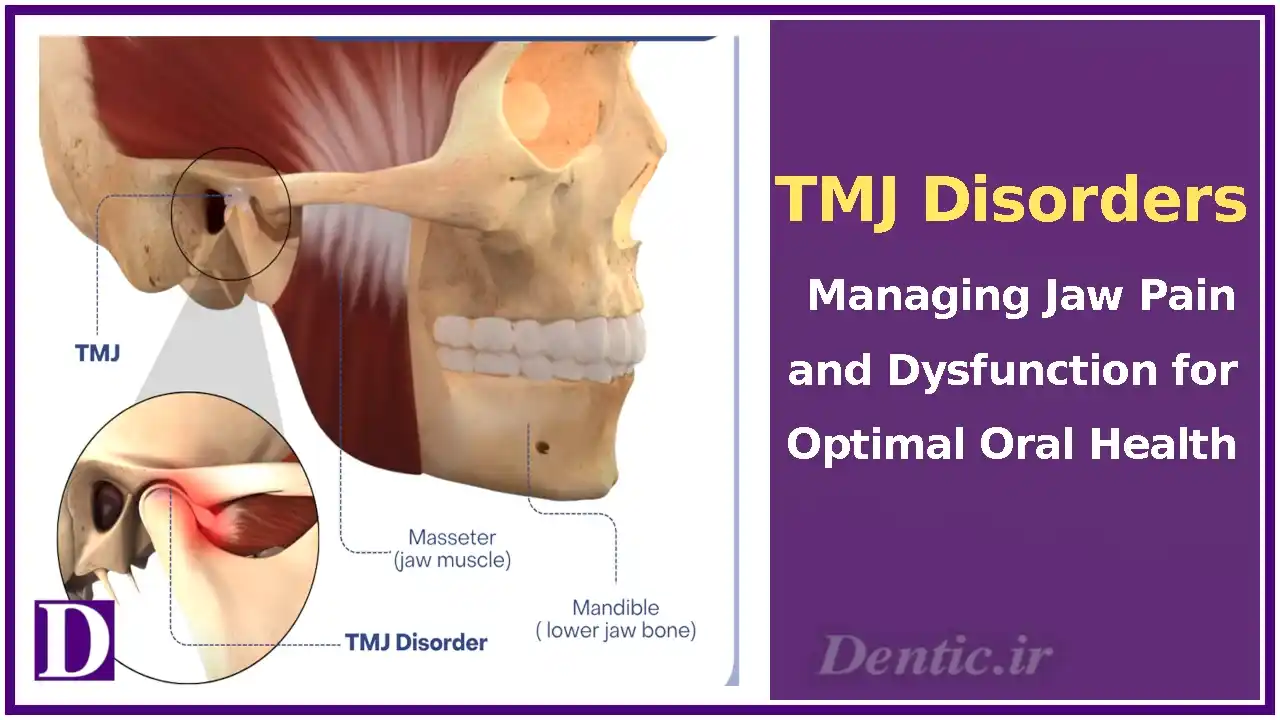 TMJ Disorders: Managing Jaw Pain and Dysfunction for Optimal Oral Health
