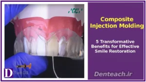 Composite Injection Molding