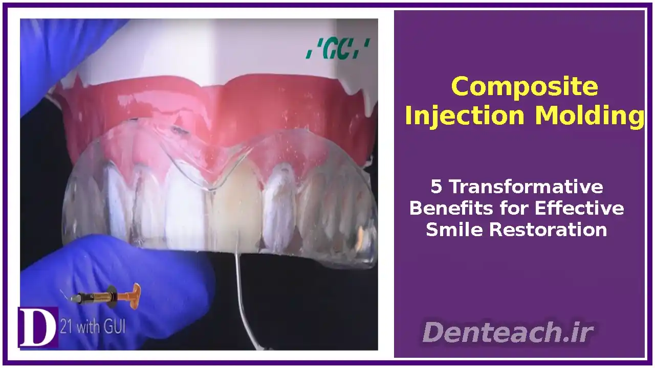 Composite Injection Molding