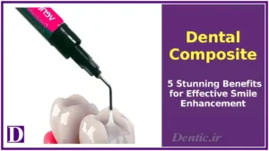 Dental Composite